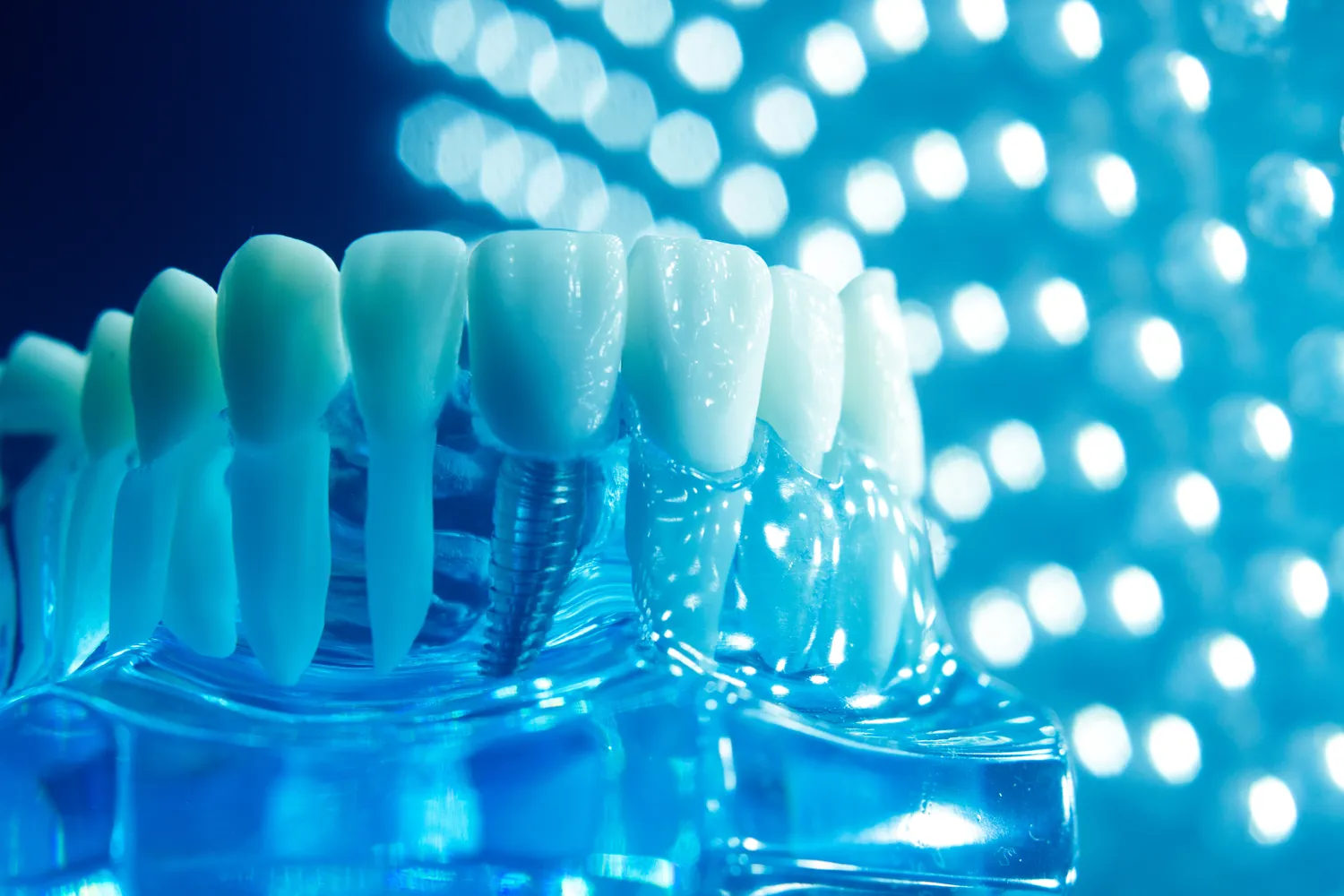 Endodoncja stomatologiczna Szczecin