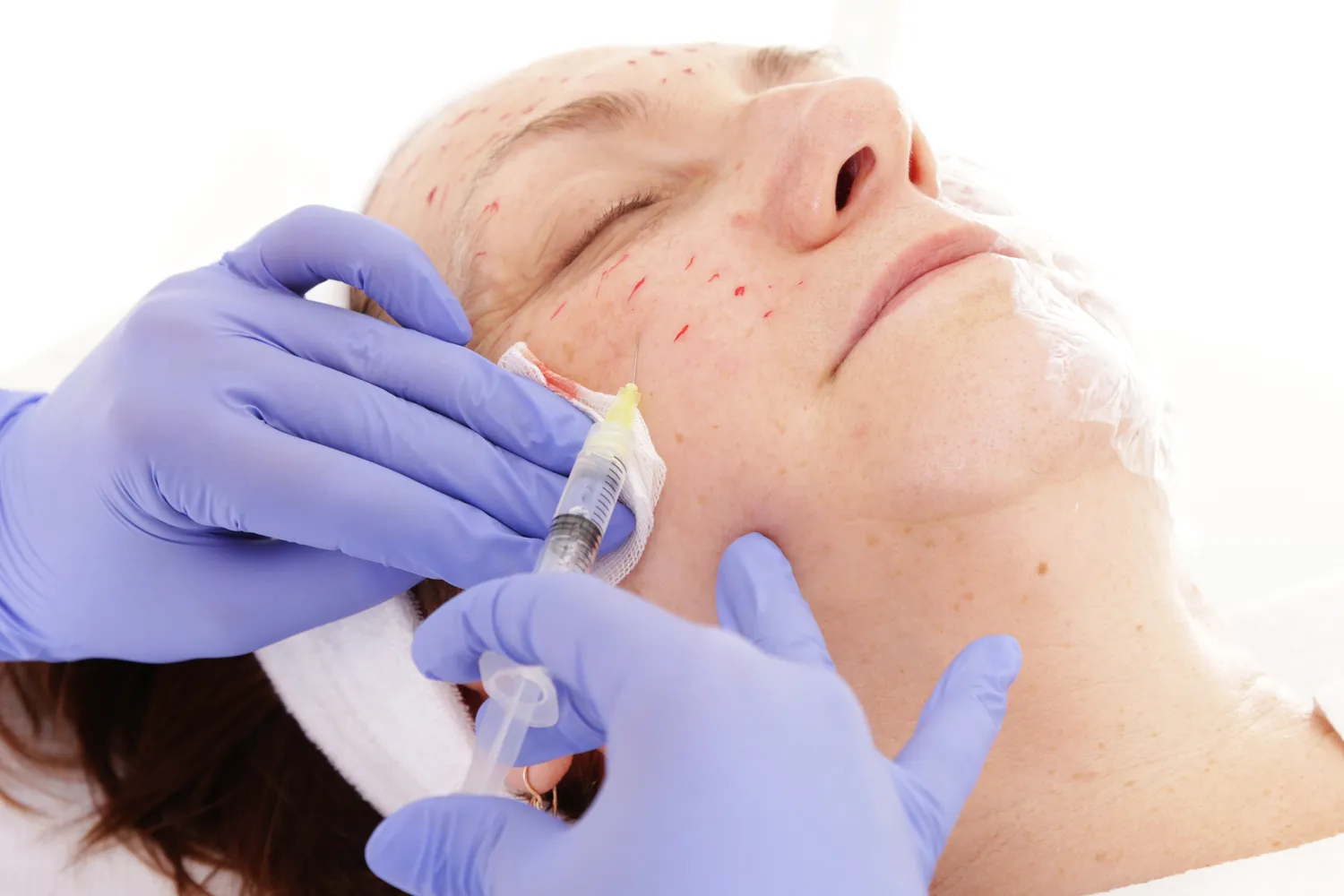 Co to kwas hialuronowy?