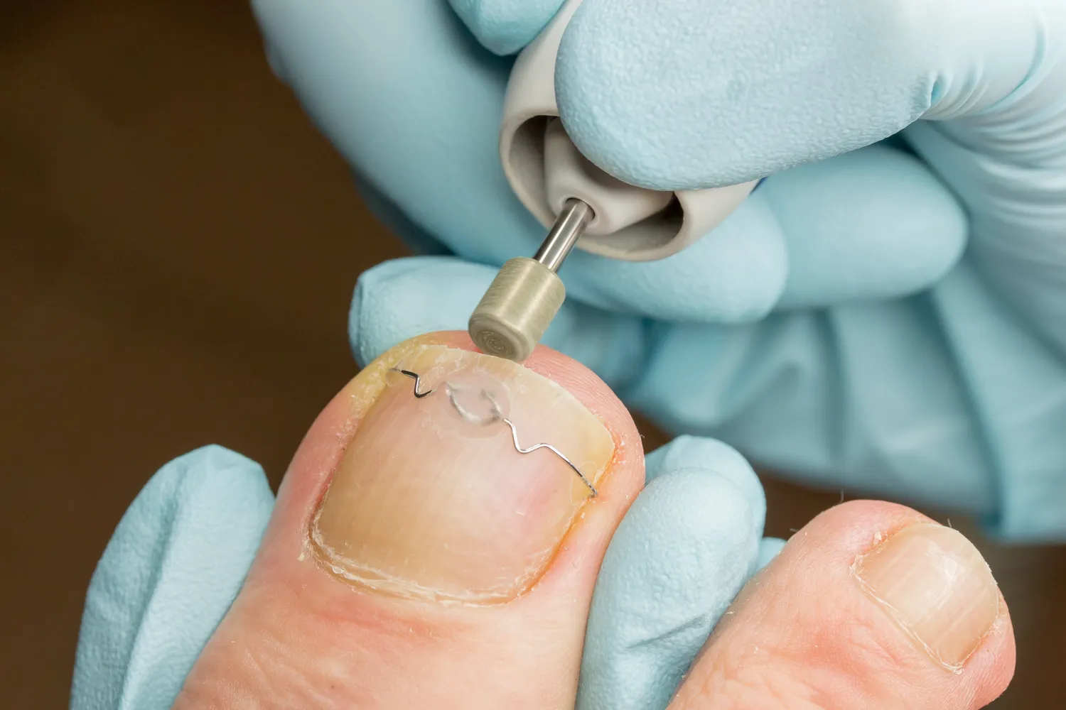  Podologia nauką o stopach